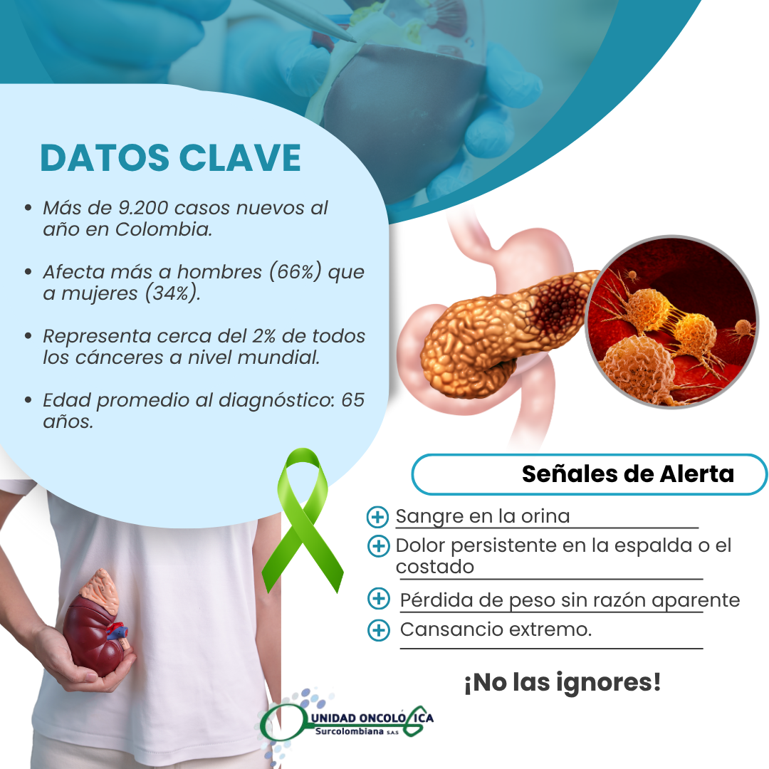 cancer de riñon 3